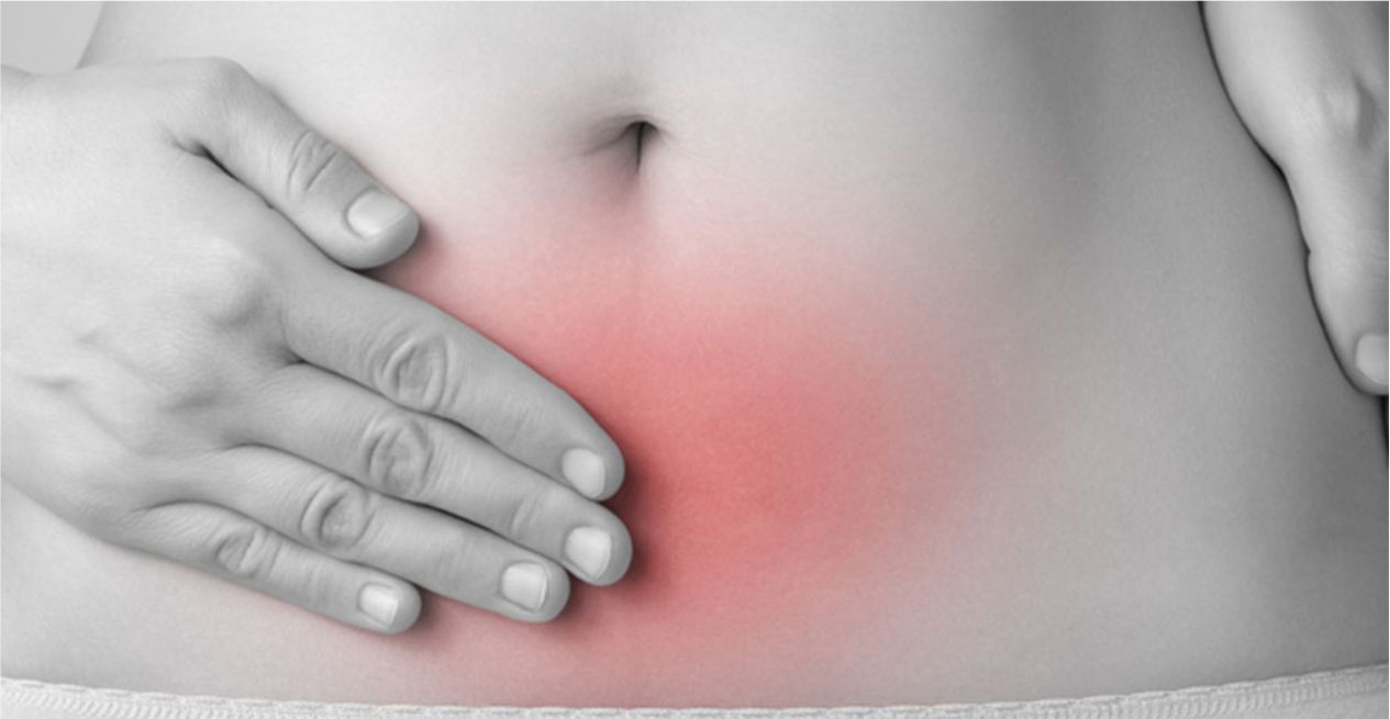 Endometriosis